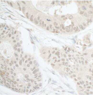 Immunohistochemistry-Paraffin: CDT2 Antibody [NB100-40840]