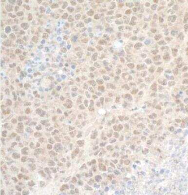 Immunohistochemistry-Paraffin: CDT2 Antibody [NB100-40840]