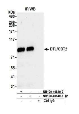 Immunoprecipitation: CDT2 Antibody [NB100-40840]