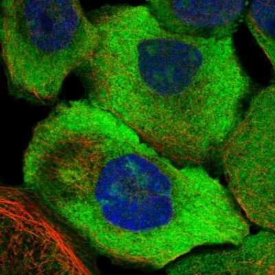 Immunocytochemistry/ Immunofluorescence: CDV3 Antibody [NBP1-81779]