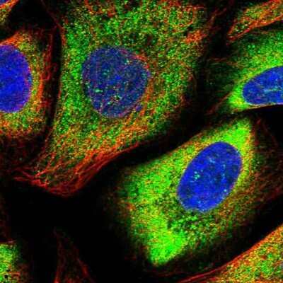 Immunocytochemistry/ Immunofluorescence: CDV3 Antibody [NBP1-81780]