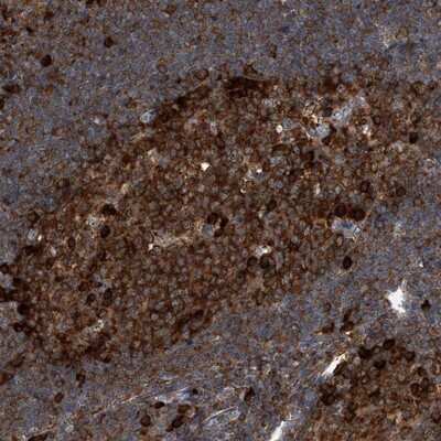Immunohistochemistry-Paraffin: CDV3 Antibody [NBP1-81779]