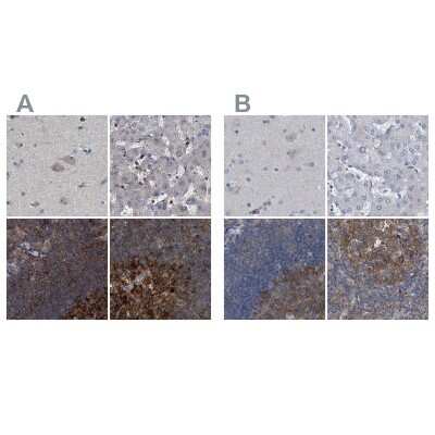Immunohistochemistry-Paraffin: CDV3 Antibody [NBP1-81779]