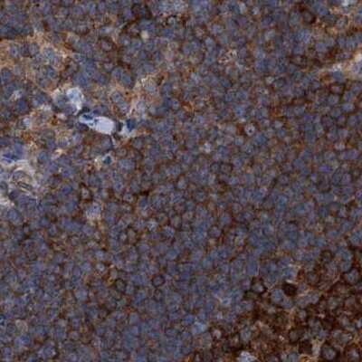 Immunohistochemistry-Paraffin: CDV3 Antibody [NBP1-81779]