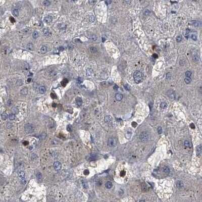 Immunohistochemistry-Paraffin: CDV3 Antibody [NBP1-81779]