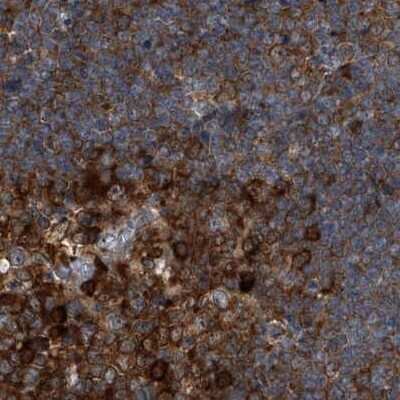 Immunohistochemistry-Paraffin: CDV3 Antibody [NBP1-81779]