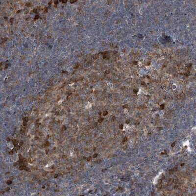 Immunohistochemistry-Paraffin: CDV3 Antibody [NBP1-81780]