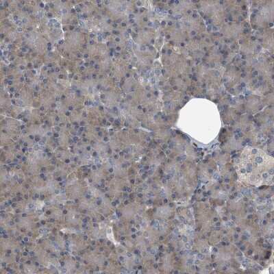 Immunohistochemistry-Paraffin: CDV3 Antibody [NBP1-81780]