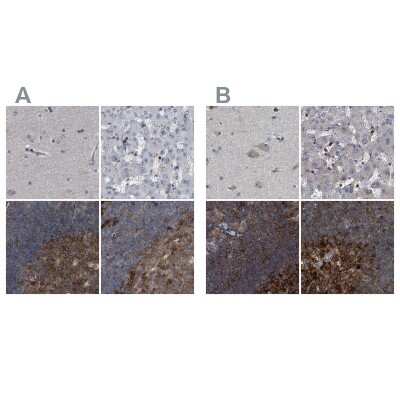 Immunohistochemistry-Paraffin: CDV3 Antibody [NBP1-81780]