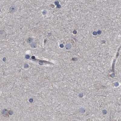 Immunohistochemistry-Paraffin: CDV3 Antibody [NBP1-81780]