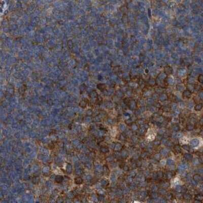 Immunohistochemistry-Paraffin: CDV3 Antibody [NBP1-81780]