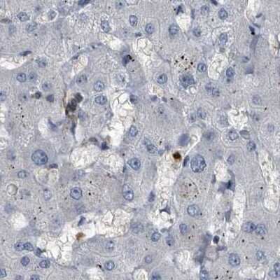 Immunohistochemistry-Paraffin: CDV3 Antibody [NBP1-81780]