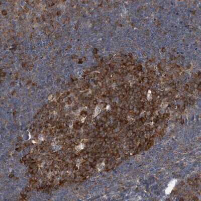 Immunohistochemistry-Paraffin: CDV3 Antibody [NBP1-81781]