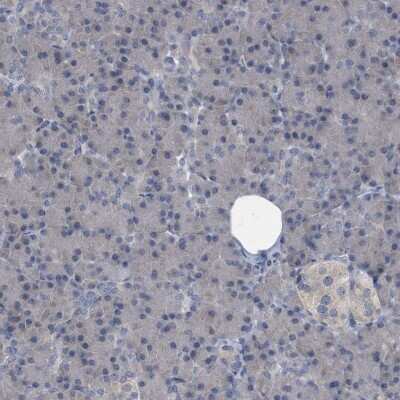 Immunohistochemistry-Paraffin: CDV3 Antibody [NBP1-81781]