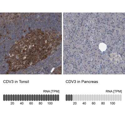 Immunohistochemistry-Paraffin: CDV3 Antibody [NBP1-81781]