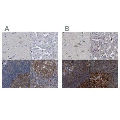 Immunohistochemistry-Paraffin: CDV3 Antibody [NBP1-81781]