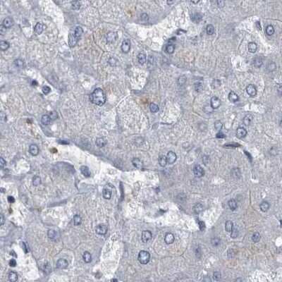 Immunohistochemistry-Paraffin: CDV3 Antibody [NBP1-81781]
