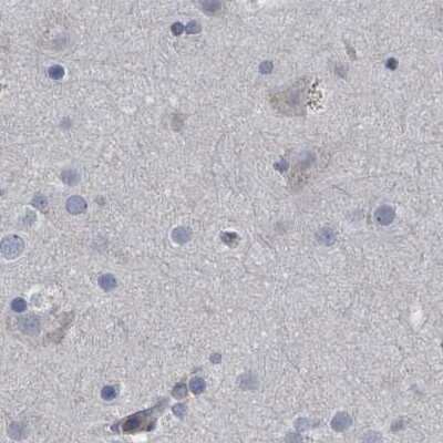 Immunohistochemistry-Paraffin: CDV3 Antibody [NBP1-81781]