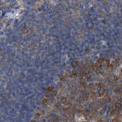 Immunohistochemistry-Paraffin: CDV3 Antibody [NBP1-81781]