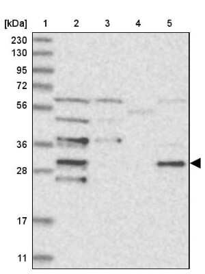 Western Blot: CDV3 Antibody [NBP1-81779]