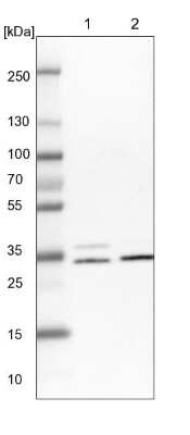 Western Blot: CDV3 Antibody [NBP1-81779]