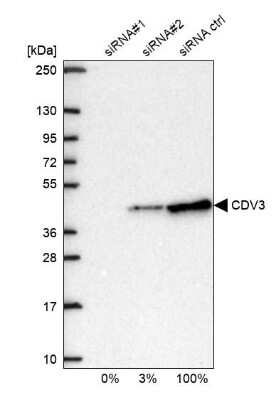 Western Blot: CDV3 Antibody [NBP1-81781]