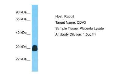 Western Blot: CDV3 Antibody [NBP2-87167]