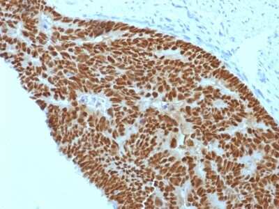 Immunohistochemistry-Paraffin: CDX2 Antibody (CDX2/1690) - Azide and BSA Free [NBP2-54472]