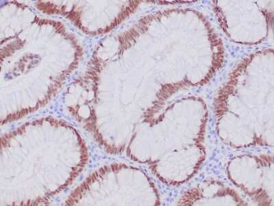 Immunohistochemistry-Paraffin: CDX2 Antibody (CDX2/4394R) - Azide and BSA Free [NBP3-08743]