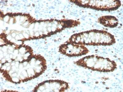 Immunohistochemistry-Paraffin: CDX2 Antibody (CDX2/4394R) - Azide and BSA Free [NBP3-08743]
