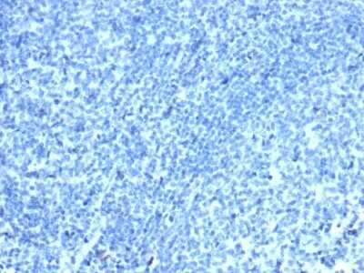 Immunohistochemistry-Paraffin: CDX2 Antibody (CDX2/4394R) [NBP3-07446]