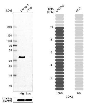 Immunocytochemistry/ Immunofluorescence: CDX2 Antibody (CL12967) [NBP3-18571]