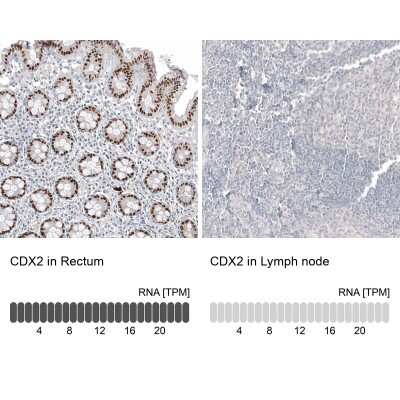 Immunohistochemistry-Paraffin: CDX2 Antibody (CL12974) [NBP3-18552]
