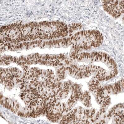 Immunohistochemistry-Paraffin: CDX2 Antibody (CL12974) [NBP3-18552]