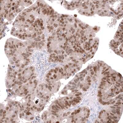Immunohistochemistry-Paraffin: CDX2 Antibody (CL12974) [NBP3-18552]
