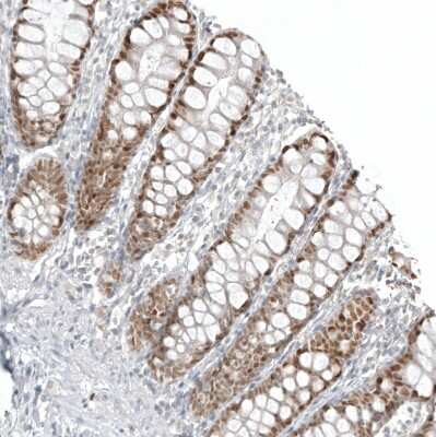 Immunohistochemistry-Paraffin: CDX2 Antibody (CL12974) [NBP3-18552]