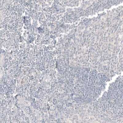 Immunohistochemistry-Paraffin: CDX2 Antibody (CL12974) [NBP3-18552]