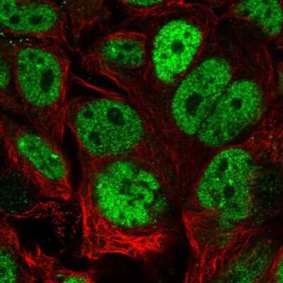 Immunocytochemistry/ Immunofluorescence: CDX2 Antibody [NBP2-56683]