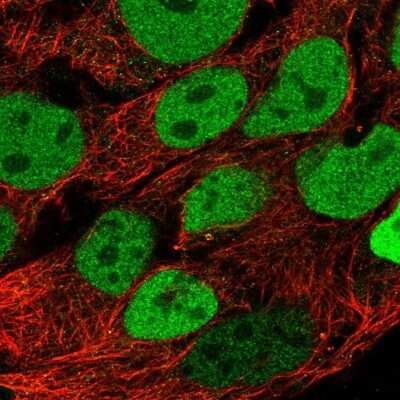 Immunocytochemistry/ Immunofluorescence: CDX2 Antibody [NBP2-58280]