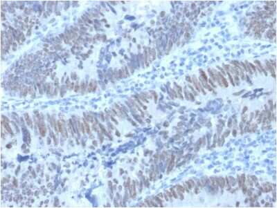 Immunohistochemistry-Paraffin: CDX2 Antibody (PCRP-CDX2-1A3) - Azide and BSA Free [NBP2-75759]