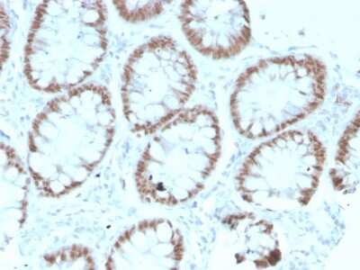 Immunohistochemistry-Paraffin: CDX2 Antibody (rCDX2/1690) - Azide and BSA Free [NBP3-08737]