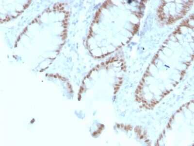 Immunohistochemistry-Paraffin: CDX2 Antibody (rCDX2/1690) [NBP3-07444]