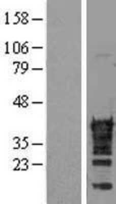 Western Blot: CDX2 Overexpression Lysate [NBL1-09065]