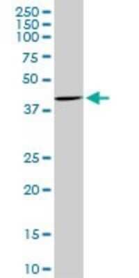 Western Blot: CDX4 Antibody (1E11) [H00001046-M16]