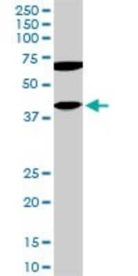 Western Blot: CDX4 Antibody (2H7) [H00001046-M11]