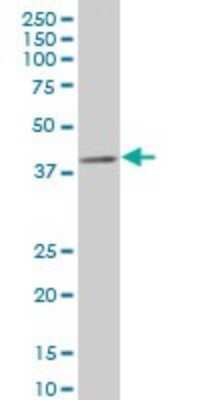 Western Blot: CDX4 Antibody (2H7) [H00001046-M11]