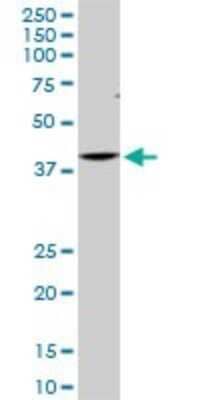 Western Blot: CDX4 Antibody (2H7) [H00001046-M11]