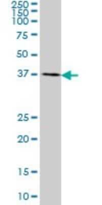 Western Blot: CDX4 Antibody (3F3) [H00001046-M06]