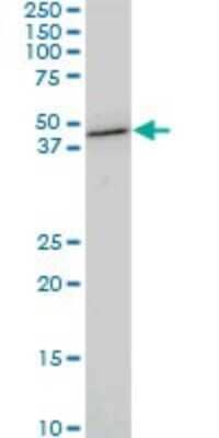 Western Blot: CDX4 Antibody (3F3) [H00001046-M06]