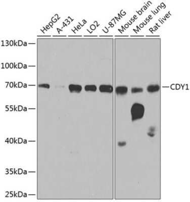 Western Blot: CDY1 AntibodyBSA Free [NBP3-05663]